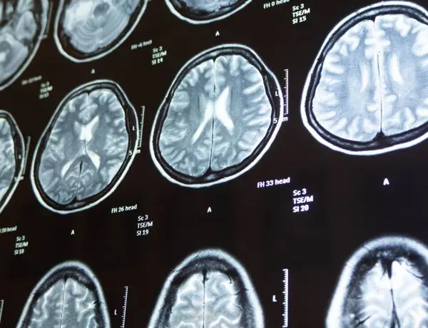 Displays an array of brain tumours on a screen