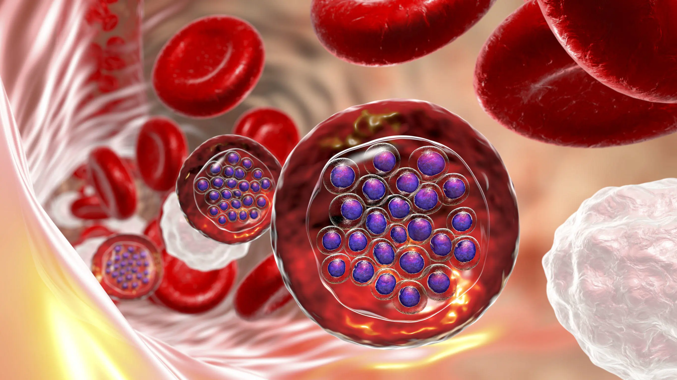 3d cgi of malaria-infected red blood cells
